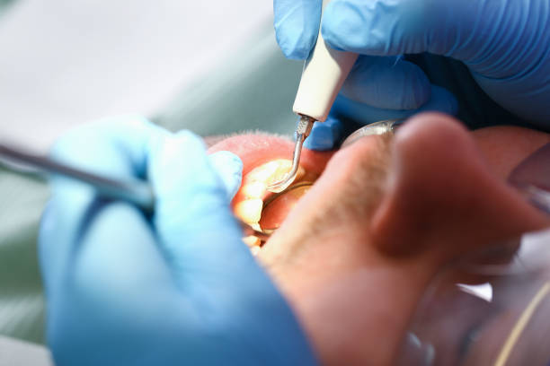 Best Pediatric Emergency Dentist in Laton, CA