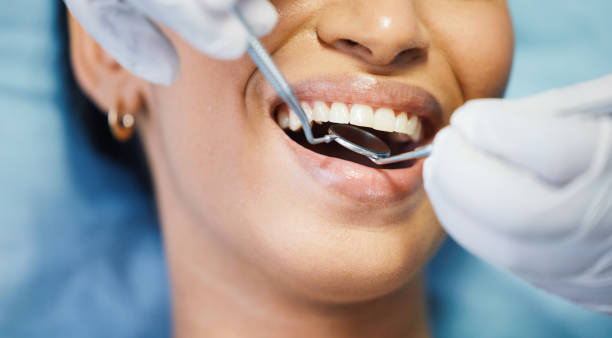 Best Broken or Cracked Tooth Emergency Dentist in Laton, CA