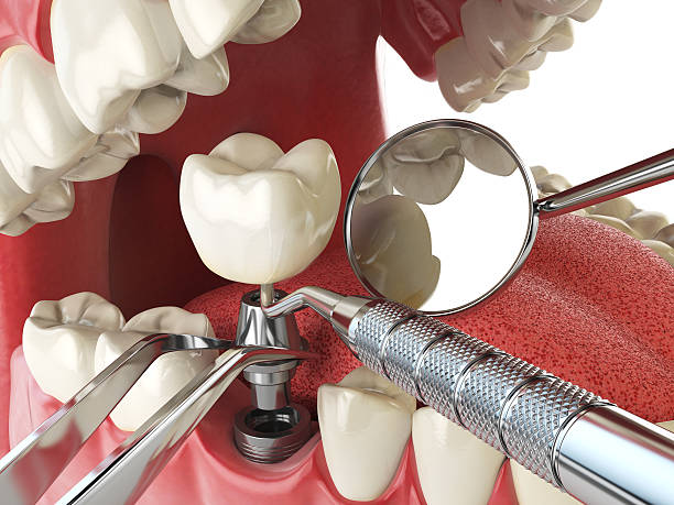 Best Weekend Emergency Dentist in Laton, CA